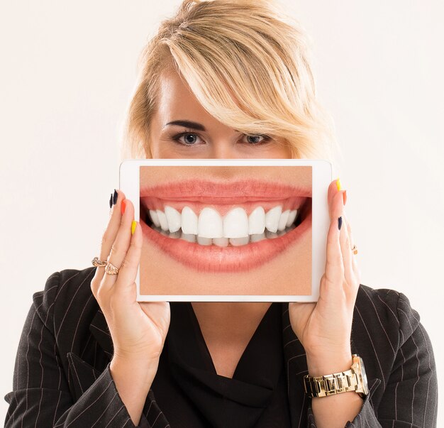 Four Essential Insights into Dental Veneers