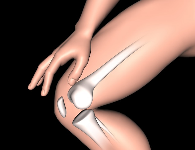 Knee Osteoarthritis: Commonality, Contributing Factors, and Treatment Alternatives